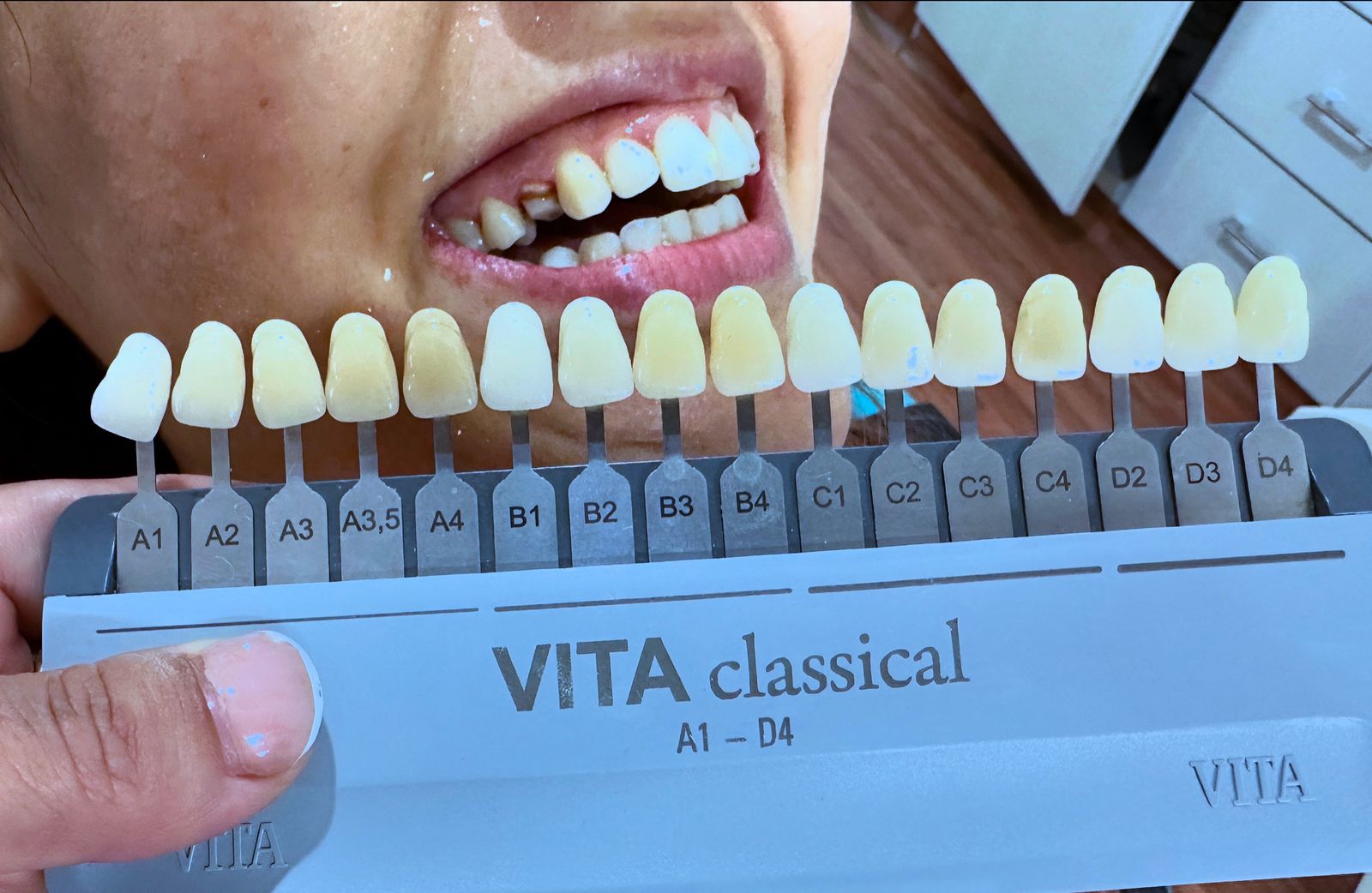 About Hello Dental Clinic - Our modern dental facility